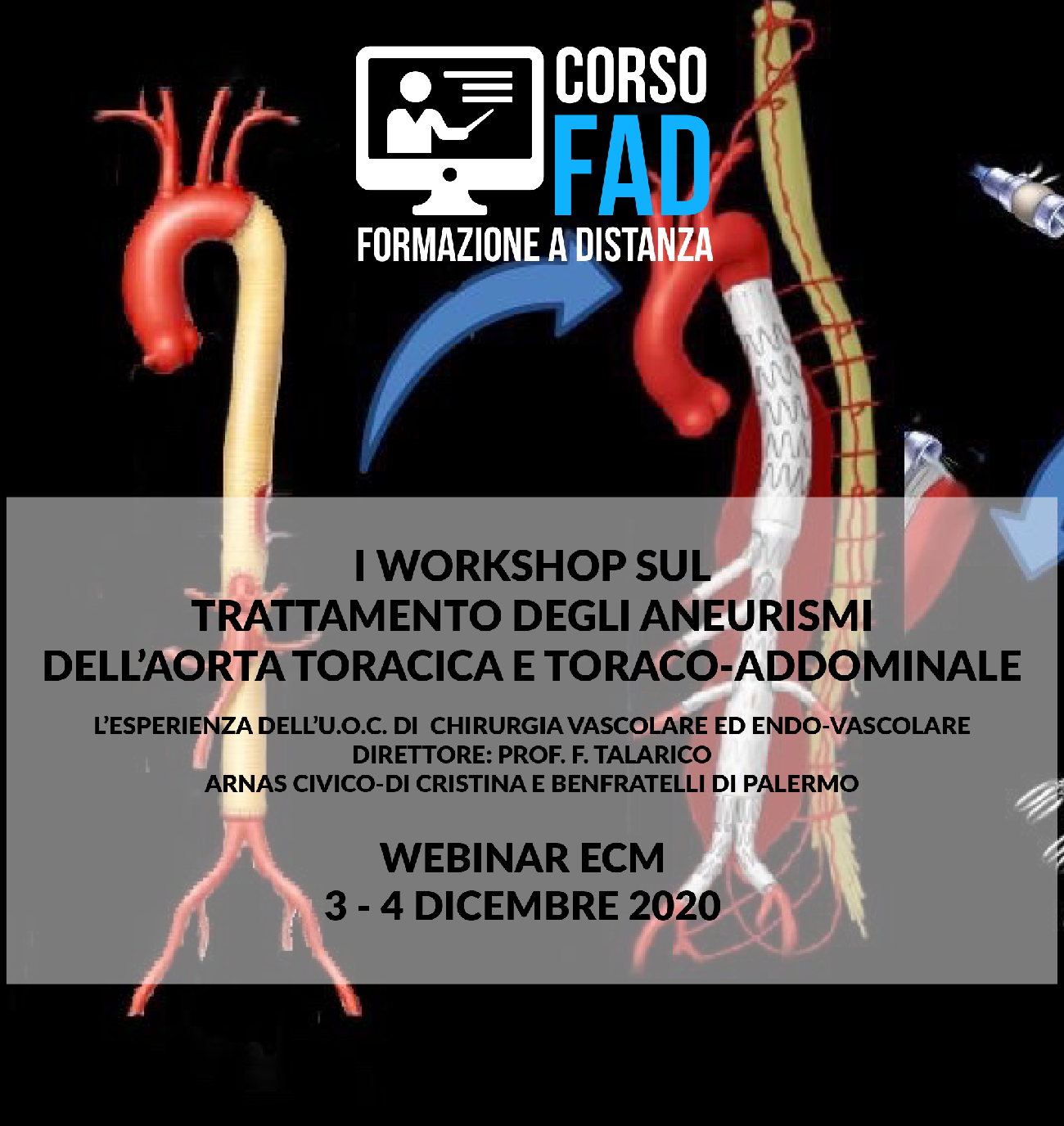 ANNULLATO - WORKSHOP SUL TRATTAMENTO DEGLI ANEURISMI DELL'AORTA TORACICA E TORACO-ADDOMINALE. L'ESPERIENZA DELL'U.O.C.DI CHIRURGIA VASCOLARE ED ENDO-VASCOLARE.