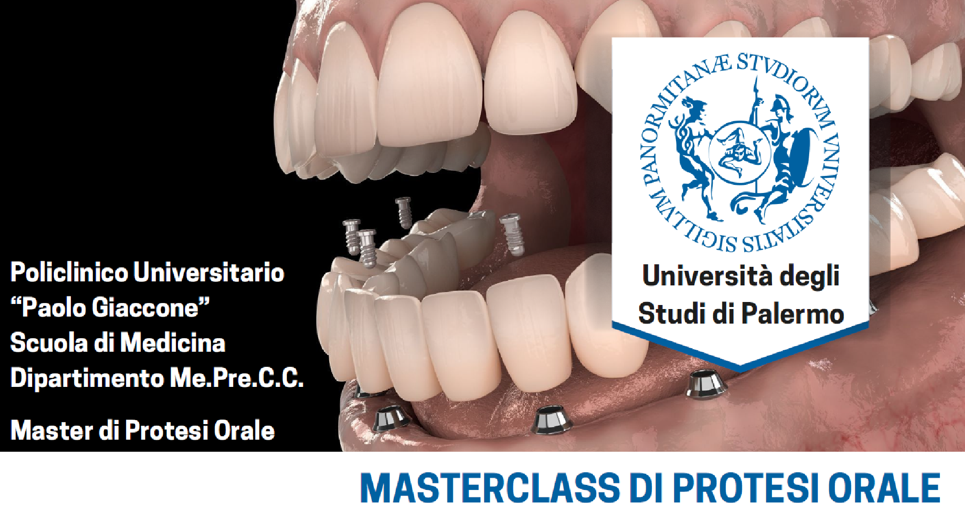 MASTERCLASS DI PROTESI ORALE 